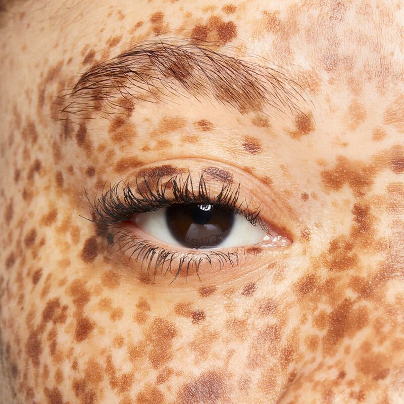 Close-up of heavily freckled model&rsquo;s eye area before using the limited-edition Mary Kay Brow Kit in Brunette
